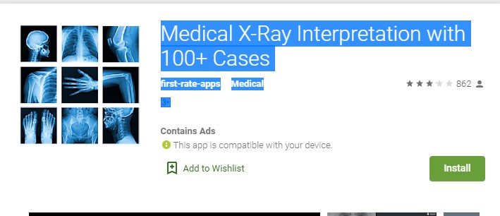 Medical X-Ray Interpretation